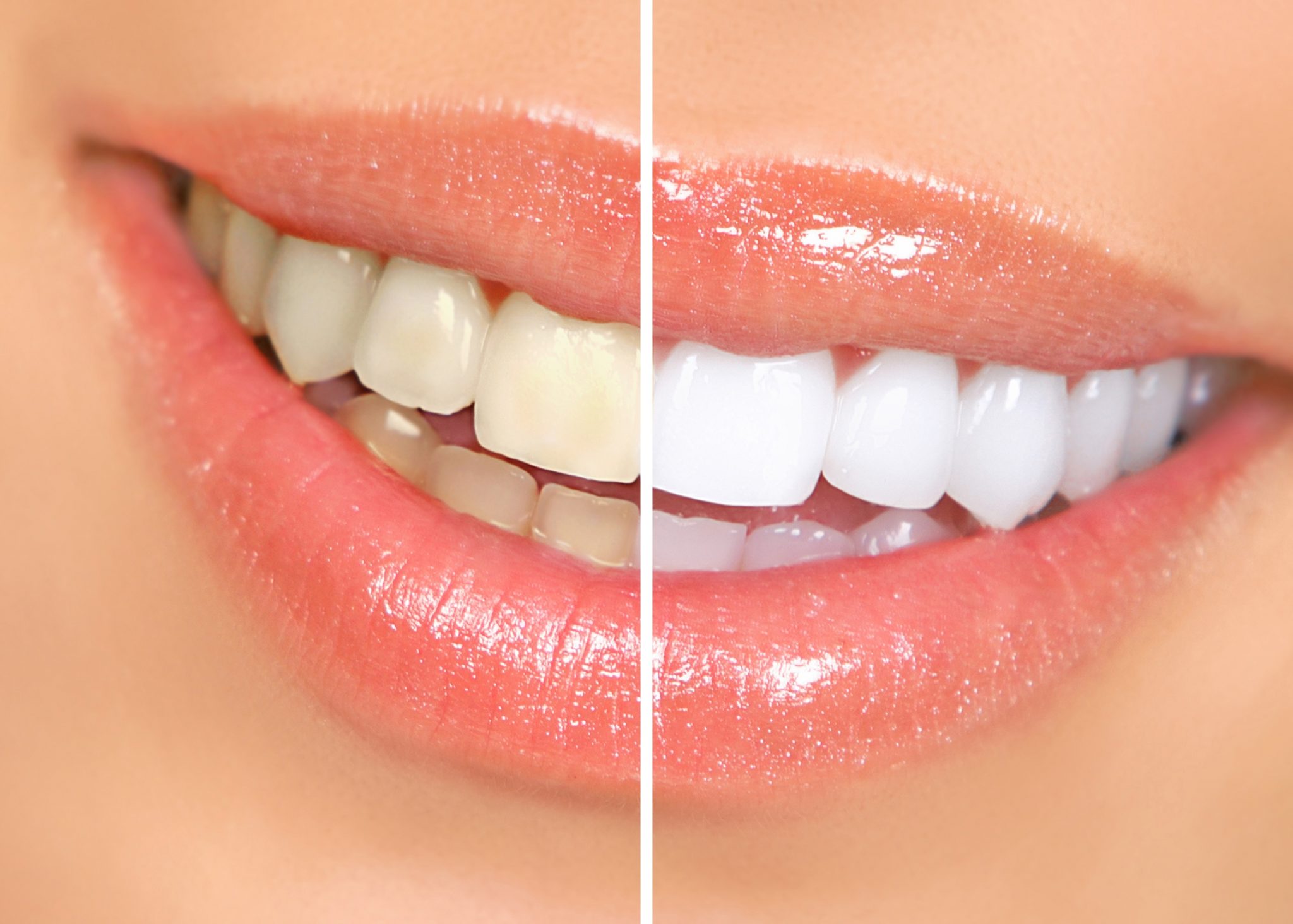 5 Unique Natural Remedies For Getting Those Pearly Whites